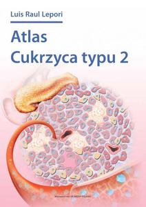 Atlas cukrzycy typu 2 - 2848938571