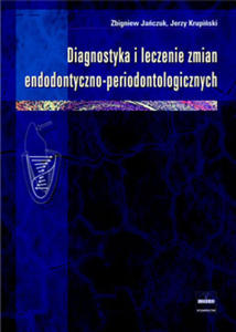 Diagnostyka i leczenie zmian endodontyczno-periodontologicznych