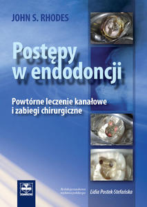 Postpy w endodoncji Powtórne leczenie kanaowe i zabiegi chirurgiczne.