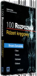 100 rozpozna. Rdze krgowy