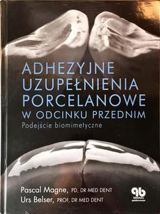 Adhezyjne uzupenienia porcelanowe w odcinku przednim - 2822221054