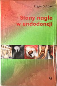 Stany nage w endodoncji - 2848935759