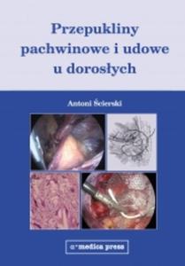 Przepukliny pachwinowe i udowe u dorosych - 2822221122