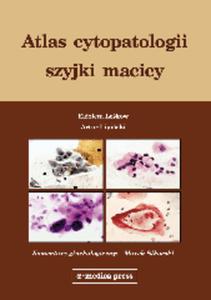 Atlas cytopatologii szyjki macicy - 2822221143