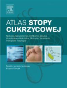 Atlas stopy cukrzycowej - 2822221301