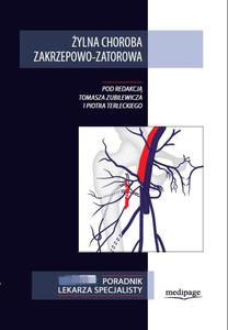 ylna choroba zakrzepowo-zatorowa. Zubilewicz, Terlecki - 2822222296