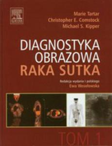 Diagnostyka Obrazowa Raka Sutka Tom 1 - 2845963665