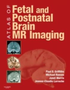 Atlas Of Fetal And Postnatal Brain Mr - 2849915535