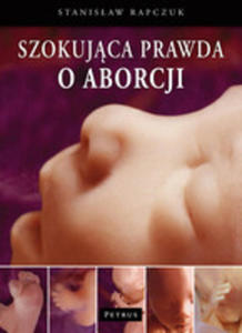 Szokujca Prawda O Aborcji - 2839293806