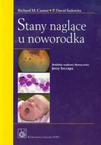 Stany naglce u noworodka - 2868738575