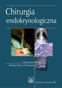 Chirurgia endokrynologiczna - 2868738600