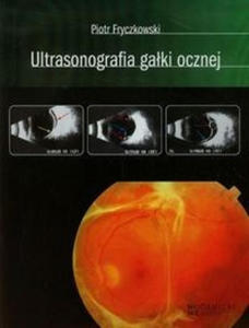 Ultrasonografia gaki ocznej - 2869474379