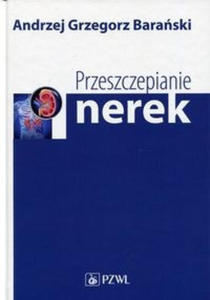 Przeszczepianie nerek - 2859209416