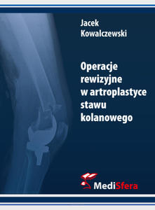 Operacje rewizyjne w artroplastyce stawu kolanowego - 2874063496