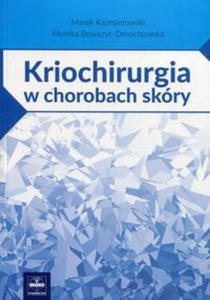 Kriochirurgia w chorobach skry - 2859209555