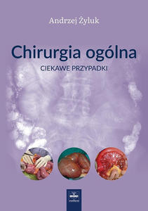 Chirurgia oglna. Ciekawe przypadki - 2870558186