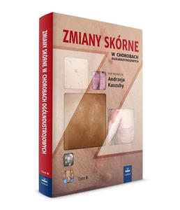 Zmiany skrne w chorobach oglnoustrojowych. Tom 3 - 2859209822