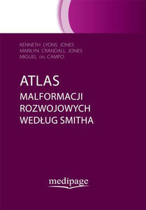 ATLAS MALFORMACJI ROZWOJOWYCH WEDUG SMITHA - 2859210017