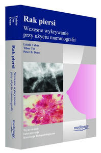 RAK PIERSI - WCZESNE WYKRYWANIE PRZY UYCIU MAMMOGRAFII TABAR - 2859210240