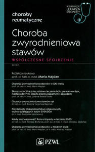 Choroba zwyrodnieniowa staww - 2859210551