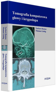 TOMOGRAFIA KOMPUTEROWA GOWY I KRGOSUPA (COMPUTERTOMOGRAPHIE VON KOPF UND WIRBELSULE) HOSTEN - 2872449053