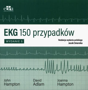 EKG 150 przypadkw - 2859210598