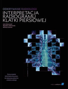 Odkrywanie radiologii: interpretacja radiogramu klatki piersiowej - 2877442849