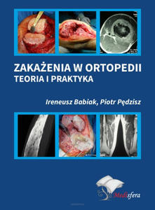 Zakaenia w ortopedii. Teoria i praktyka - 2874063514