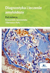 Diagnostyka i leczenie amyloidozy - 2871047545