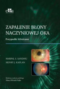 Zapalenie bony naczyniowej oka - 2871544439