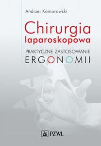 Chirurgia laparoskopowa Praktyczne zastosowanie ergonomii - 2860839683