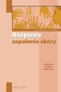 Atopowe zapalenie skry Poradnik lekarza praktyka - 2860839785