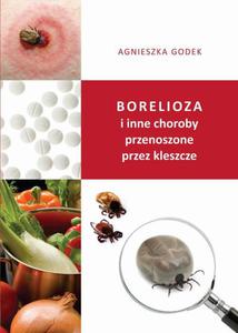 Borelioza i inne choroby przenoszone przez kleszcze - 2860861705