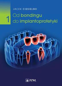 Od bondingu do implantoprotetyki Cz 1 - 2873962553