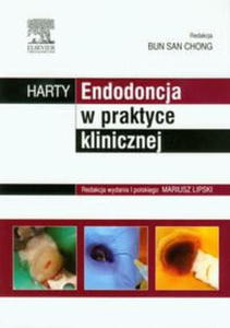 HARTY ENDODONCJA W PRAKTYCE KLINICZNEJ B CHONG - 2860159633