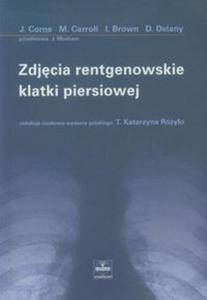 ZDJCIE RENTGENOWSKIE KLATKI PIERSIOWEJ 0,3/ CZELEJ - 2857608222