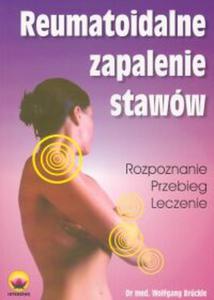 Reumatoidalne zapalenie stawow - 2857618253