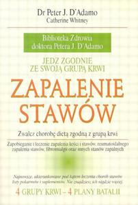 Zapalenie staww - 2825655347