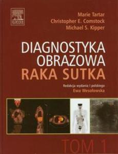 Diagnostyka obrazowa raka sutka Tom 1 - 2857626211