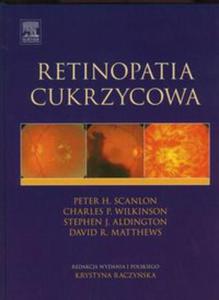 Retinopatia cukrzycowa - 2857626388