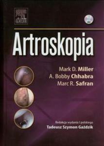 Artroskopia - 2857626549