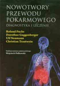 Nowotwory przewodu pokarmowego - 2857627738