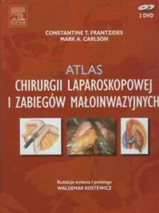 Atlas chirurgii laparoskopowej i zabiegw maoinwazyjnych - 2857628142