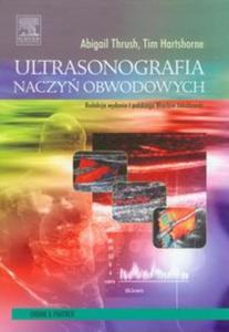 Ultrasonografia naczy obwodowych - 2857629157