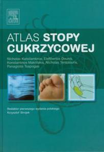 Atlas stopy cukrzycowej - 2857630513