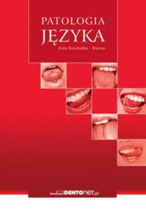 Patologia jzyka - 2857632933