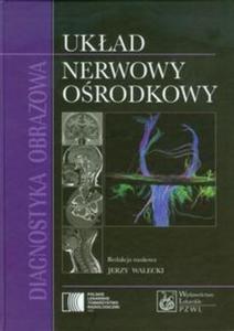 Diagnostyka obrazowa Ukad nerwowy orodkowy - 2857654001