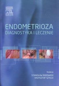 Endometrioza diagnostyka i leczenie - 2857655216