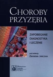 Choroby Przyzbia - 2857676708