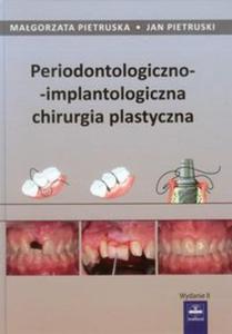 Periodontologiczno-implantologiczna chirurgia plastyczna - 2857682596